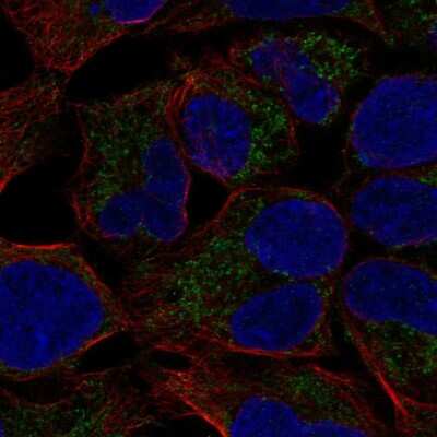 Immunocytochemistry/ Immunofluorescence: MCAT Antibody [NBP2-58354]