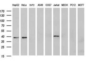 Western Blot: MCAT Antibody (OTI2B7)Azide and BSA Free [NBP2-72596]