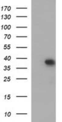 Western Blot: MCAT Antibody (OTI2B7)Azide and BSA Free [NBP2-72596]