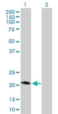 Western Blot: MCAT Antibody [H00027349-D01P]