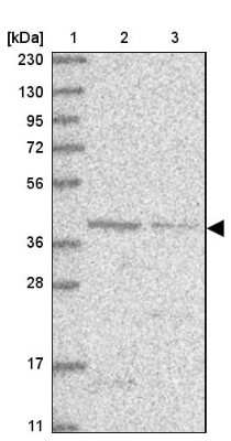 Western Blot: MCAT Antibody [NBP1-83936]