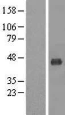 Western Blot: MCAT Overexpression Lysate [NBL1-12943]