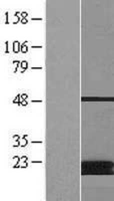 Western Blot: MCAT Overexpression Lysate [NBP2-07319]