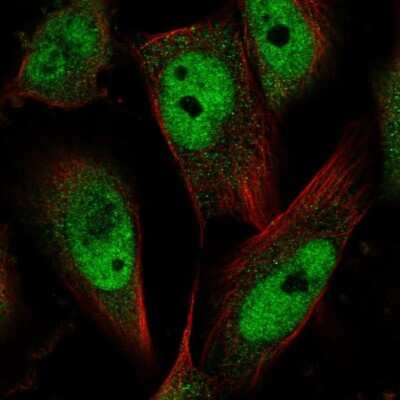 Immunocytochemistry/ Immunofluorescence: MCC Antibody [NBP2-48671]