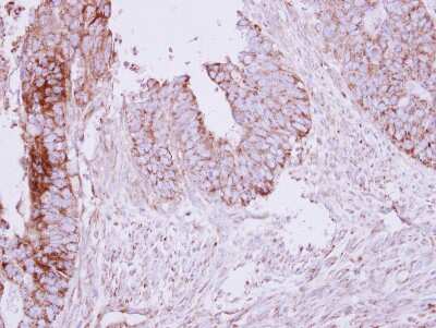 Immunohistochemistry-Paraffin: MCC Antibody [NBP2-17236]