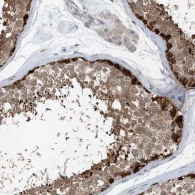 Immunohistochemistry-Paraffin: MCC Antibody [NBP2-48671]