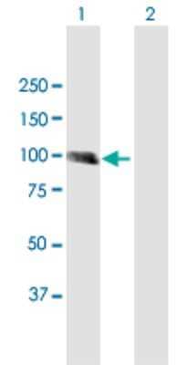 Western Blot: MCC Antibody [H00004163-B01P]