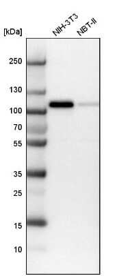 Western Blot: MCC Antibody [NBP1-85885]