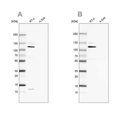 Western Blot: MCC Antibody [NBP2-48671]