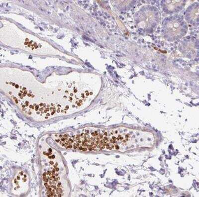 Immunohistochemistry: MCC2 Antibody [NBP2-30804]