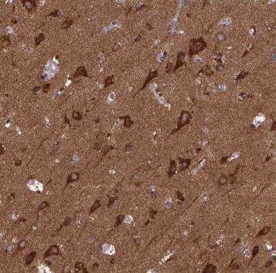 Immunohistochemistry-Paraffin: MCCC1 Antibody [NBP1-81254]