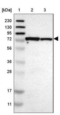 Western Blot: MCCC1 Antibody [NBP1-81254]