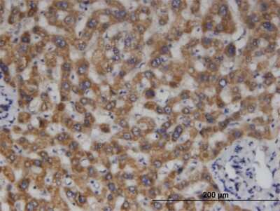 Immunohistochemistry-Paraffin: MCCC2 Antibody (2B3) [H00064087-M05]