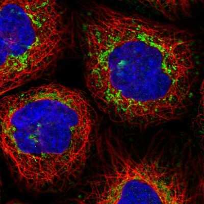 Immunocytochemistry/ Immunofluorescence: MCCC2 Antibody [NBP2-38403]