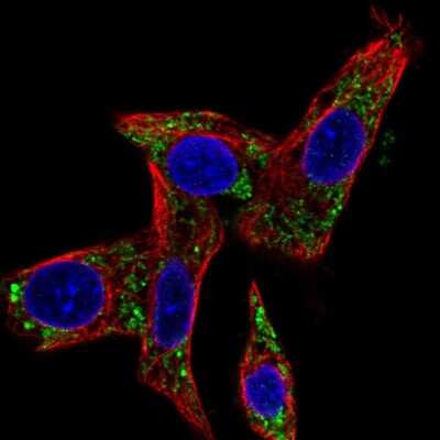 Immunocytochemistry/ Immunofluorescence: MCCC2 Antibody [NBP2-38930]
