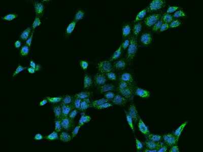 Immunocytochemistry/ Immunofluorescence: MCCC2 Antibody [NBP2-97284]