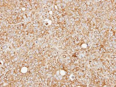 Immunohistochemistry-Paraffin: MCCC2 Antibody [NBP1-33375]