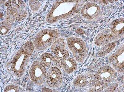 Immunohistochemistry-Paraffin: MCCC2 Antibody [NBP1-33375]