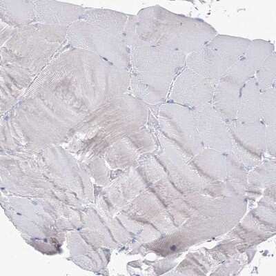 Immunohistochemistry-Paraffin: MCCC2 Antibody [NBP1-82794]