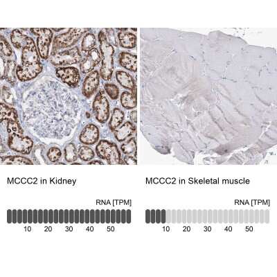 Immunohistochemistry-Paraffin: MCCC2 Antibody [NBP1-82794]