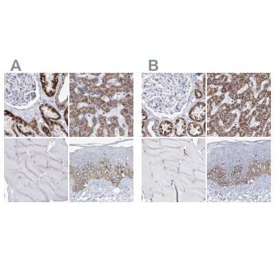 Immunohistochemistry-Paraffin: MCCC2 Antibody [NBP1-82794]