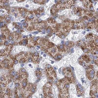 Immunohistochemistry-Paraffin: MCCC2 Antibody [NBP1-82794]