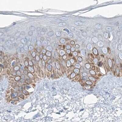 Immunohistochemistry-Paraffin: MCCC2 Antibody [NBP1-82794]
