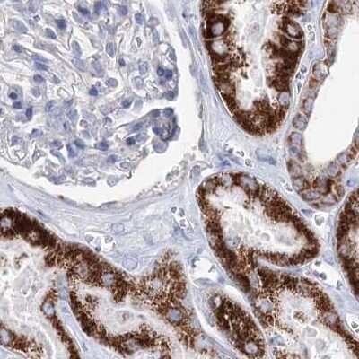 Immunohistochemistry-Paraffin: MCCC2 Antibody [NBP1-82794]