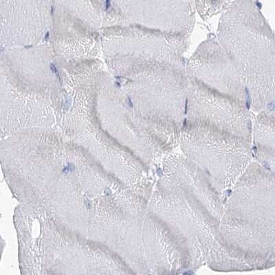 Immunohistochemistry-Paraffin: MCCC2 Antibody [NBP1-82794]