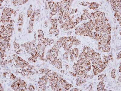 Immunohistochemistry-Paraffin: MCCC2 Antibody [NBP2-17237]