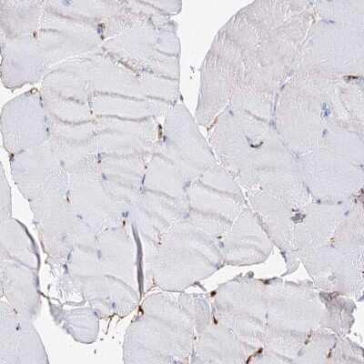 Immunohistochemistry-Paraffin: MCCC2 Antibody [NBP2-38403]