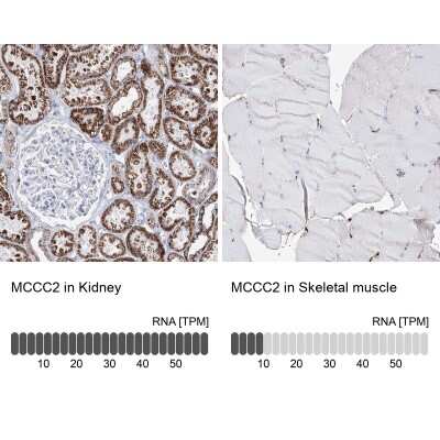 Immunohistochemistry-Paraffin: MCCC2 Antibody [NBP2-38403]