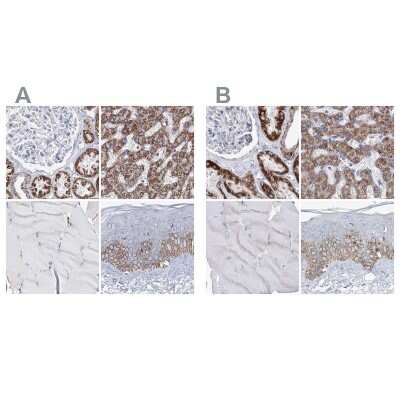 Immunohistochemistry-Paraffin: MCCC2 Antibody [NBP2-38403]