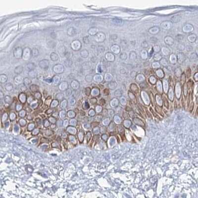 Immunohistochemistry-Paraffin: MCCC2 Antibody [NBP2-38403]