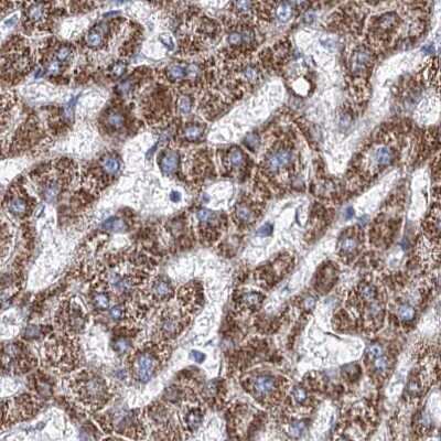 Immunohistochemistry-Paraffin: MCCC2 Antibody [NBP2-38403]
