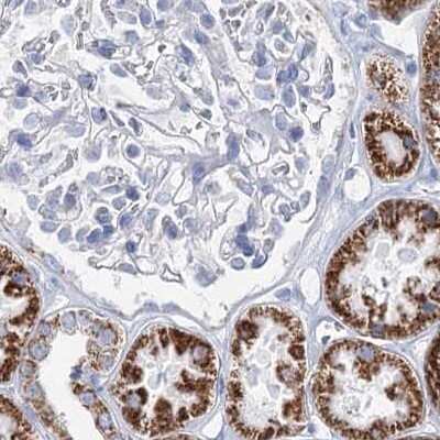 Immunohistochemistry-Paraffin: MCCC2 Antibody [NBP2-38403]