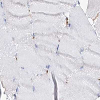 Immunohistochemistry-Paraffin: MCCC2 Antibody [NBP2-38403]