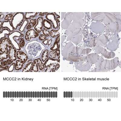 Immunohistochemistry-Paraffin: MCCC2 Antibody [NBP2-38930]