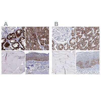 Immunohistochemistry-Paraffin: MCCC2 Antibody [NBP2-38930]