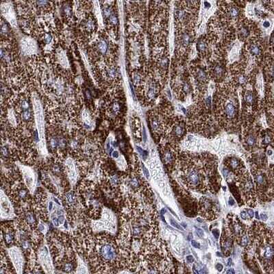 Immunohistochemistry-Paraffin: MCCC2 Antibody [NBP2-38930]