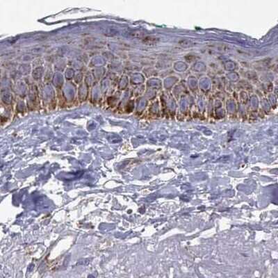 Immunohistochemistry-Paraffin: MCCC2 Antibody [NBP2-38930]