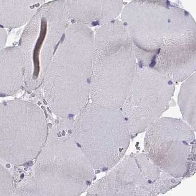 Immunohistochemistry-Paraffin: MCCC2 Antibody [NBP2-38930]