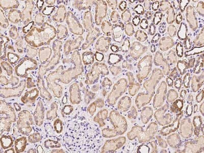 Immunohistochemistry-Paraffin: MCCC2 Antibody [NBP2-97284]