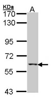 Western Blot: MCCC2 Antibody [NBP1-33375]