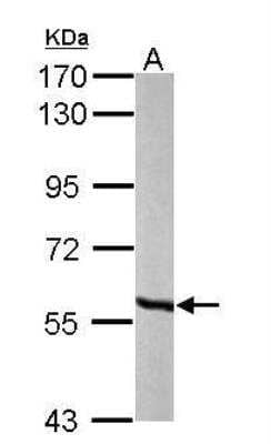 Western Blot: MCCC2 Antibody [NBP1-33375]