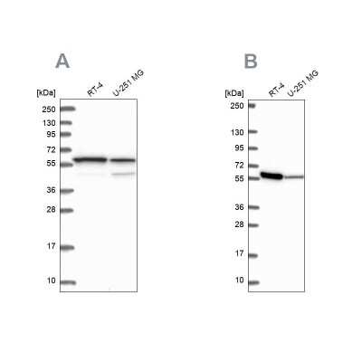 Western Blot: MCCC2 Antibody [NBP1-82794]