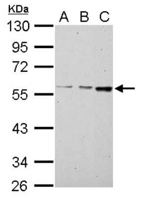 Western Blot: MCCC2 Antibody [NBP2-17237]