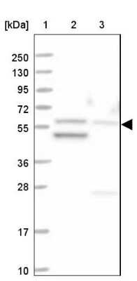 Western Blot: MCCC2 Antibody [NBP2-38403]