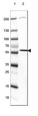 Western Blot: MCCC2 Antibody [NBP2-38403]