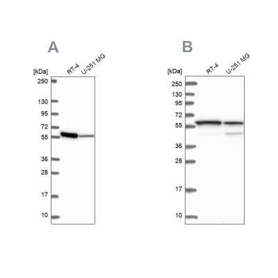 Western Blot: MCCC2 Antibody [NBP2-38930]